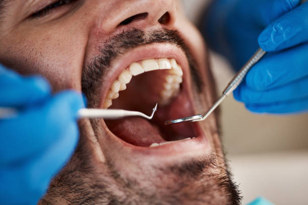 Best Walk-In Emergency Dentist in Davidson, NC